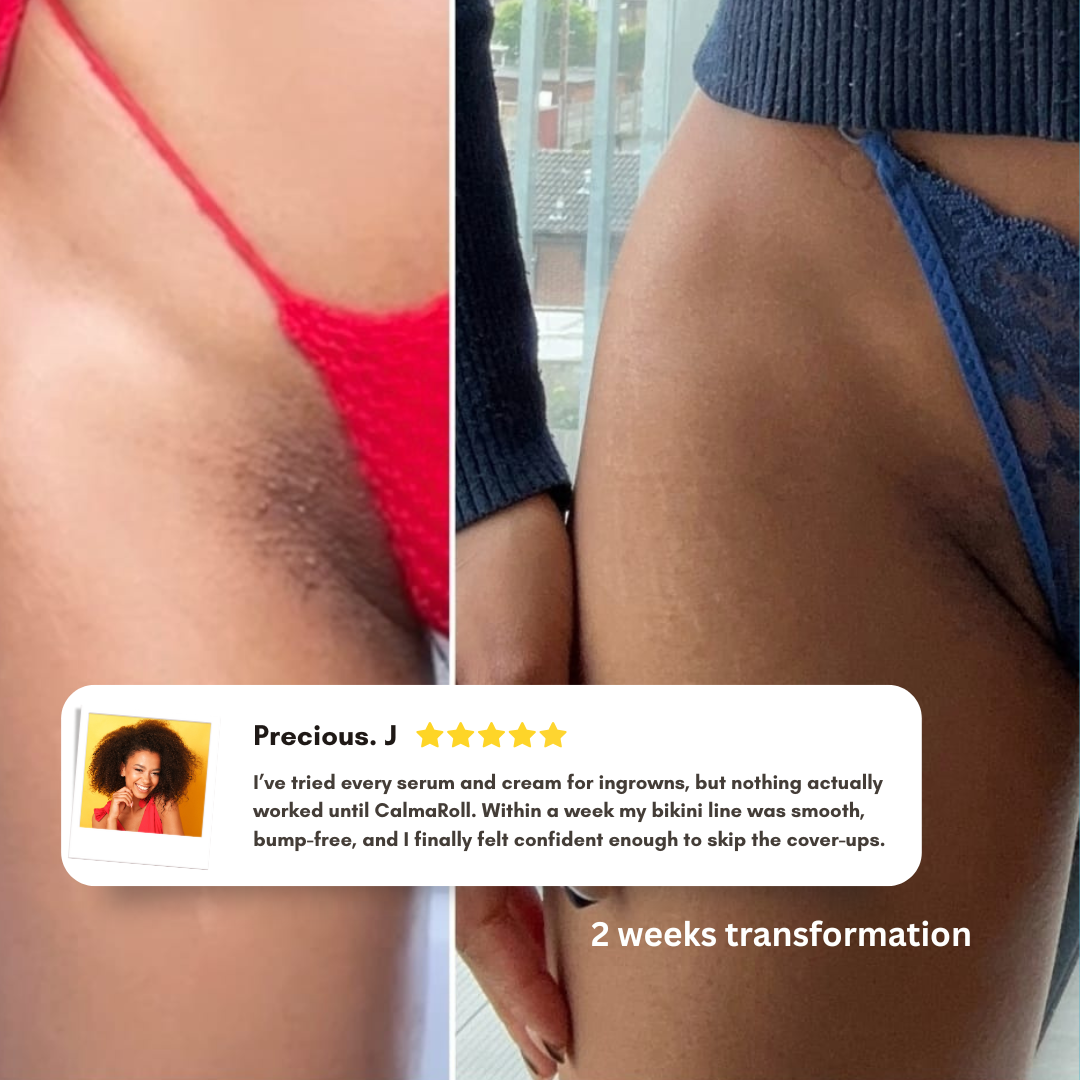 CalmaRoll | Smoothing Solution