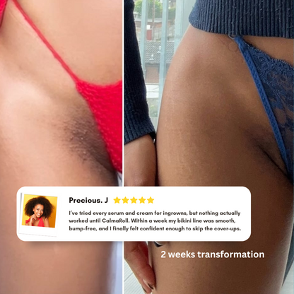 CalmaRoll | Smoothing Solution