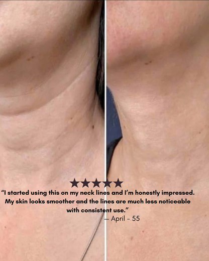 Gleama – Silicone Scar Stick