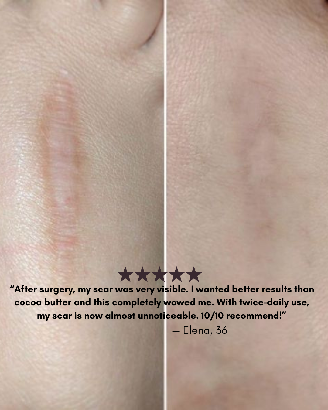 Gleama – Silicone Scar Stick