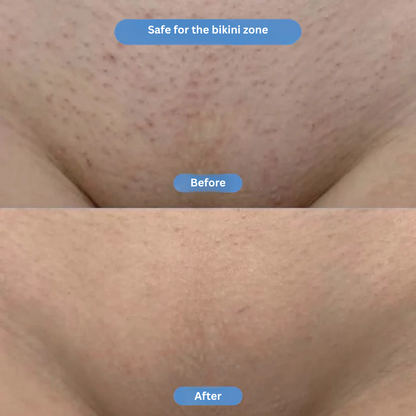 CalmaRoll | Smoothing Solution