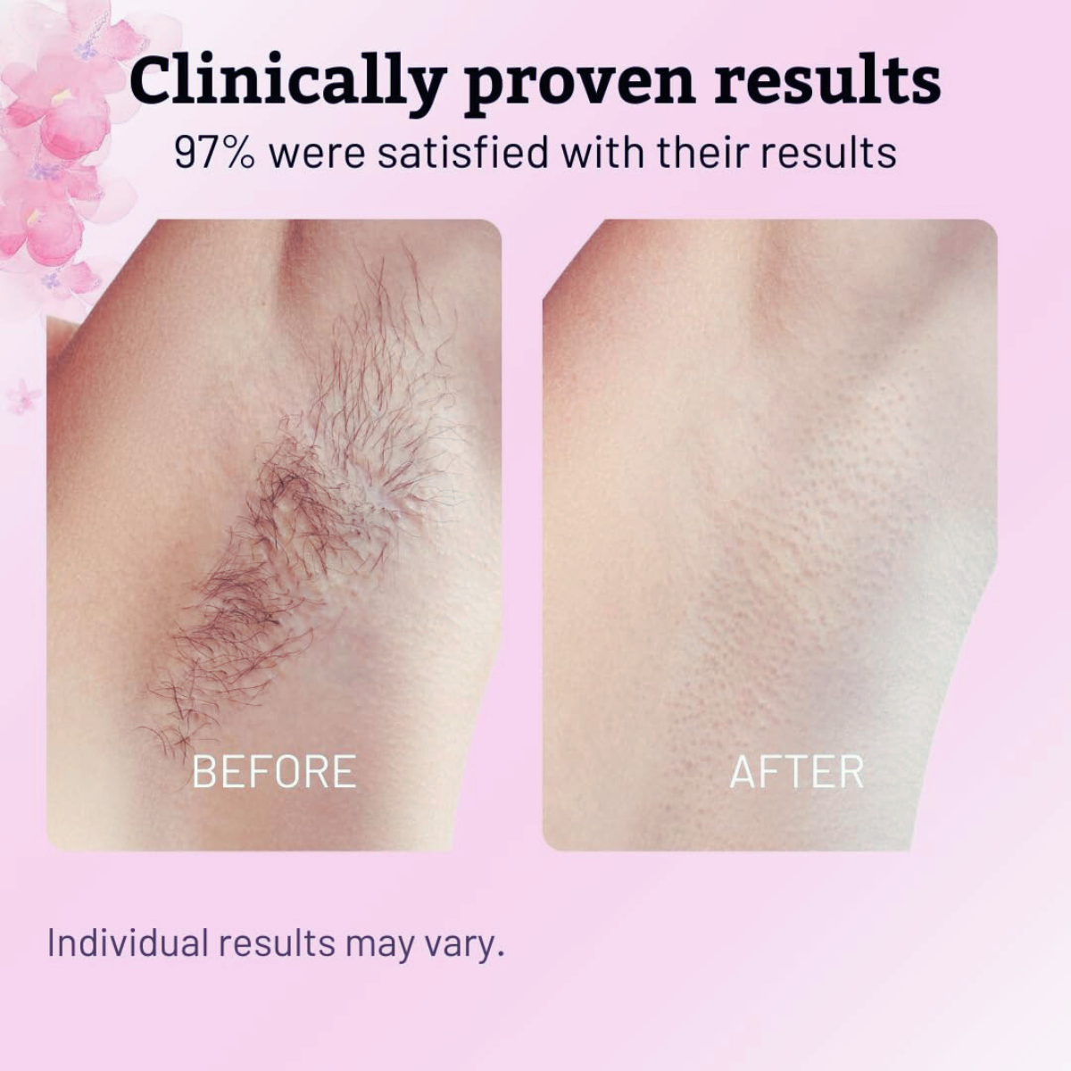 Cyperus Rotundus | Hair Minimizing Serum