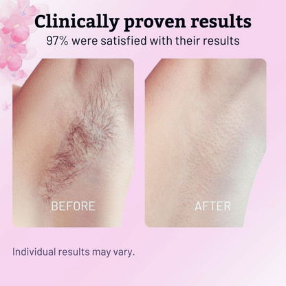 Cyperus Rotundus | Hair Minimizing Serum