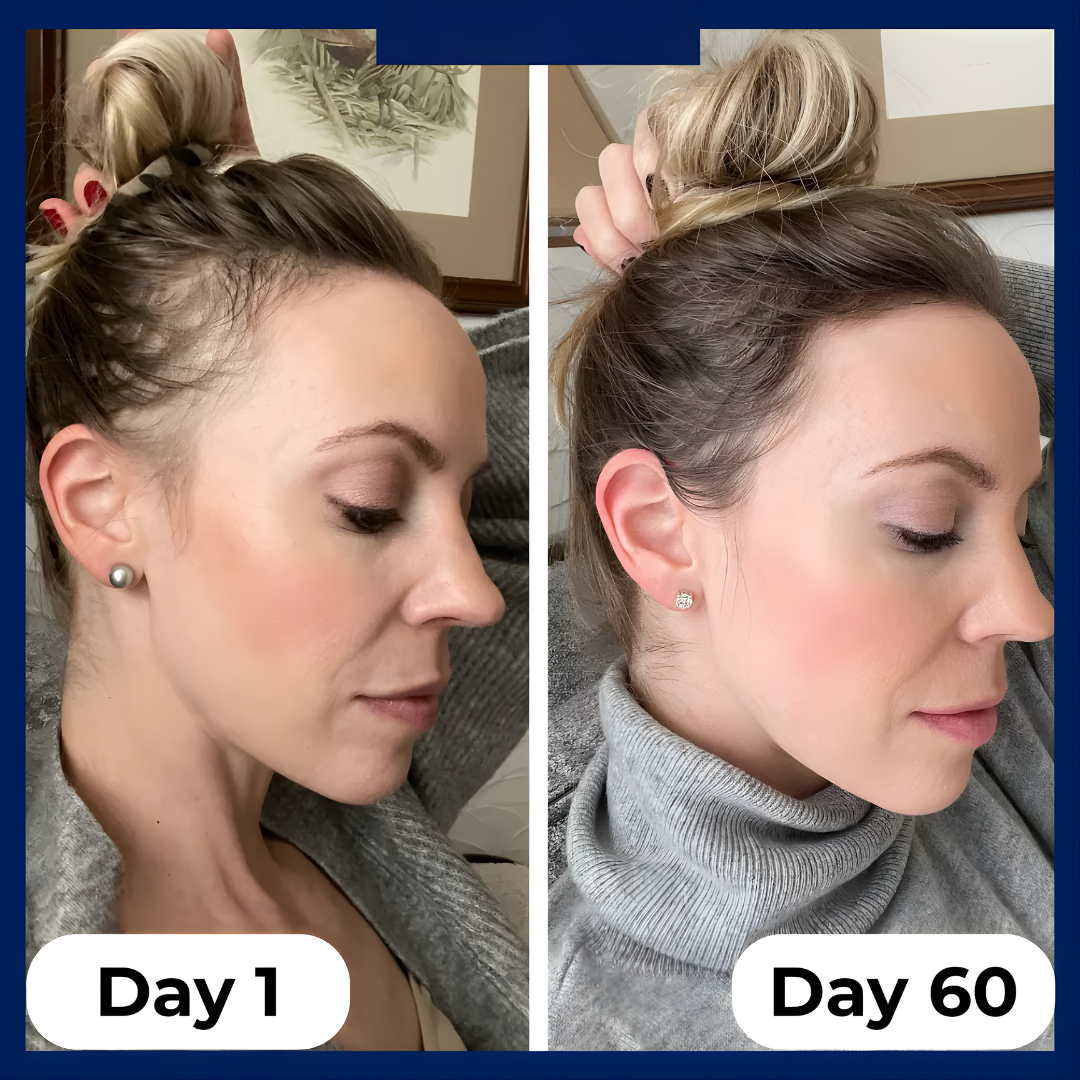 GrowEase™ Hair Growth Serum Roll-on