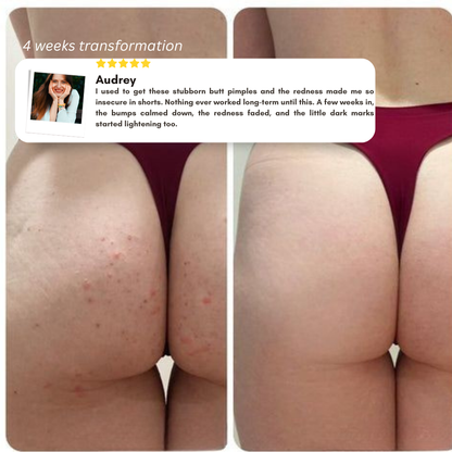 CalmaRoll | Roll Calmante